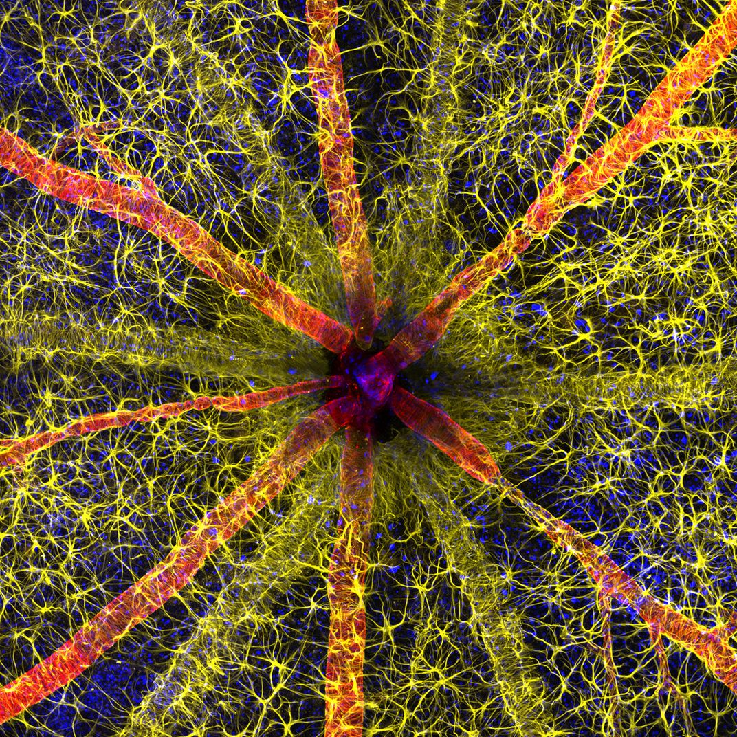 1 Colorful image of rodent's optic nerve head