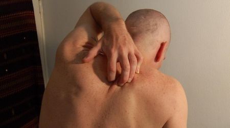 A neurotransmitter called Nppb, we now know, plays a vital role in the sensation of an itch—and removing it can prevent itchiness entirely.