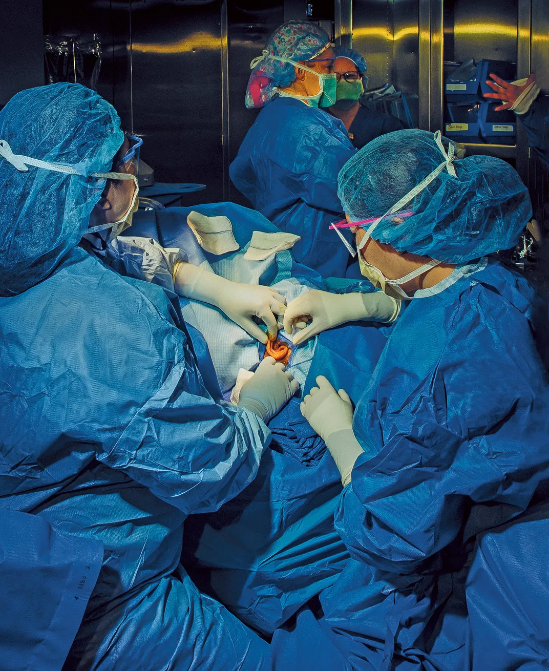 An ear surgery