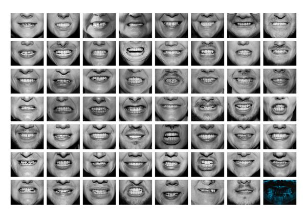 Why do you cover your mouth with your hand when you laugh? thumbnail