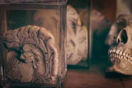 This brain is just one of many making up the Indiana Medical History Museum's extensive collection. 