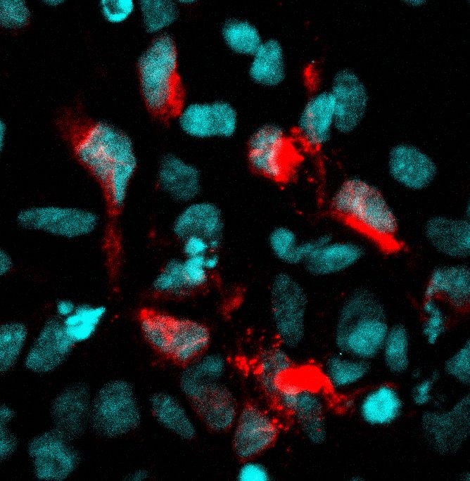 Zika infected cells