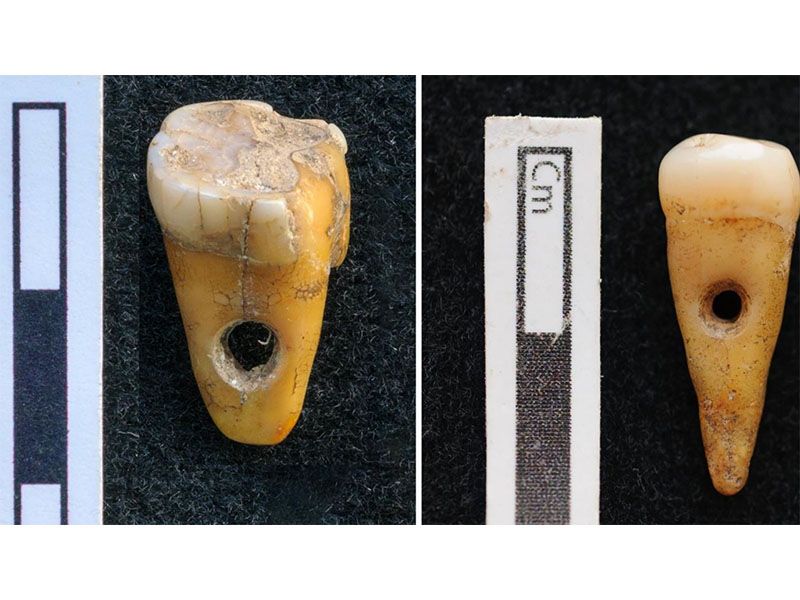 Archaeologists Unearth Beads Made of Human Teeth in Ancient Turkish City, Smart News