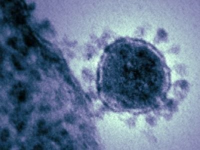 An electron micrograph of the coronavirus.
