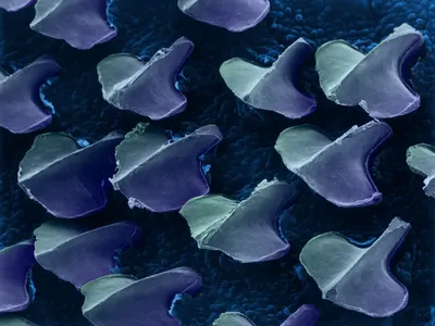 Dogfish shark denticles viewed using a scanning electron microscope. 