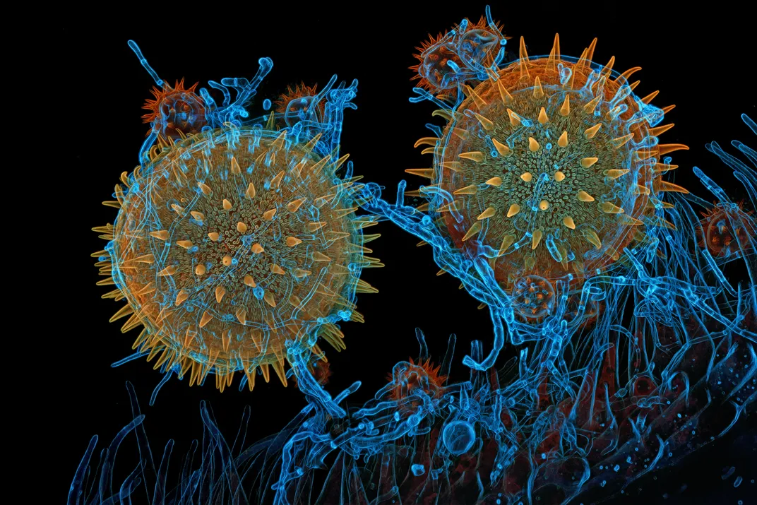 spiky spheres wrapped in blue filaments