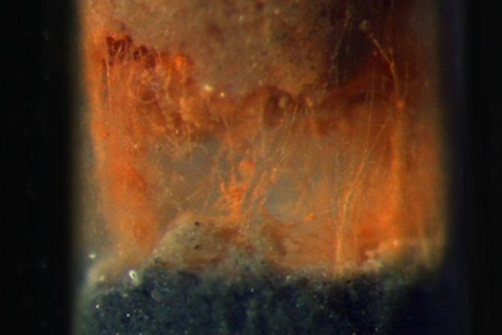 Microscopic bacteria