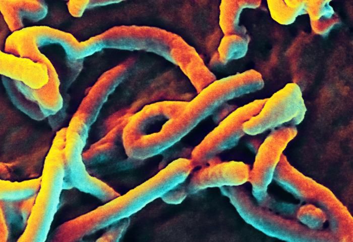 Ebola virus particles