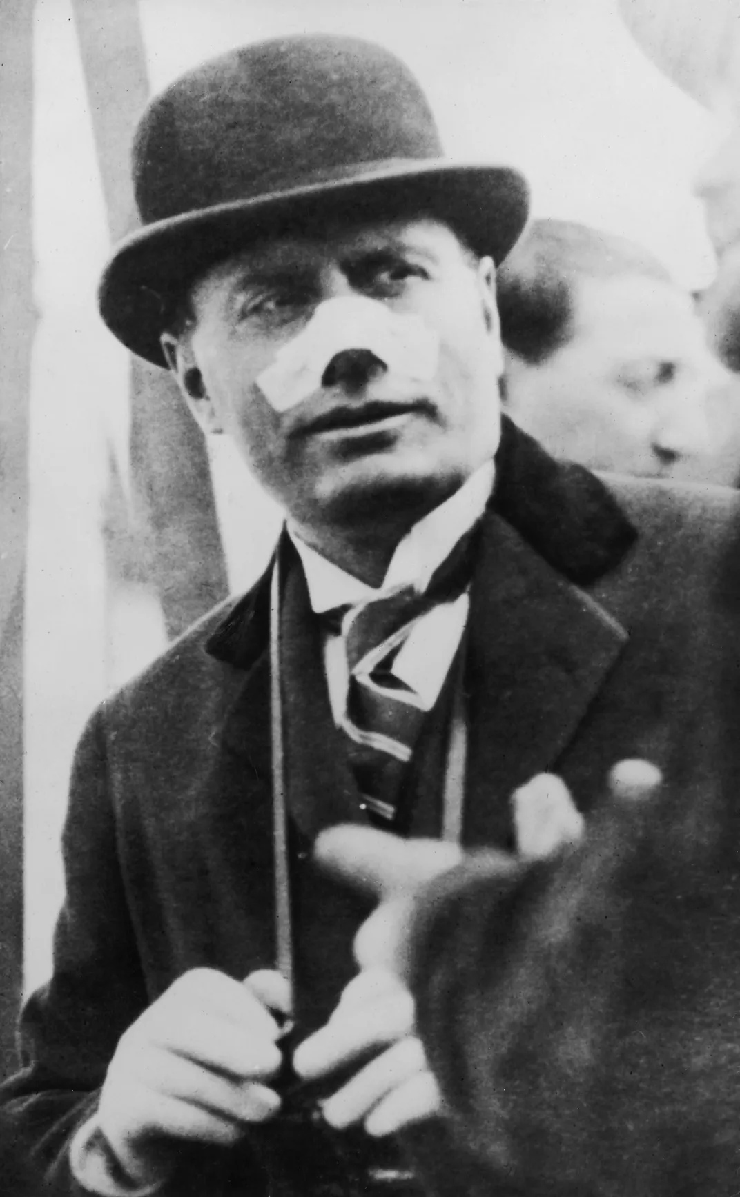 A black and white close up of Mussolini, a white man in a bowler hat and suit and tie, with a large white bandage over his nose 