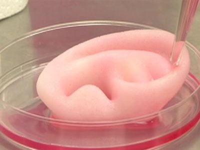 This artificial ear was made on a 3D printer.