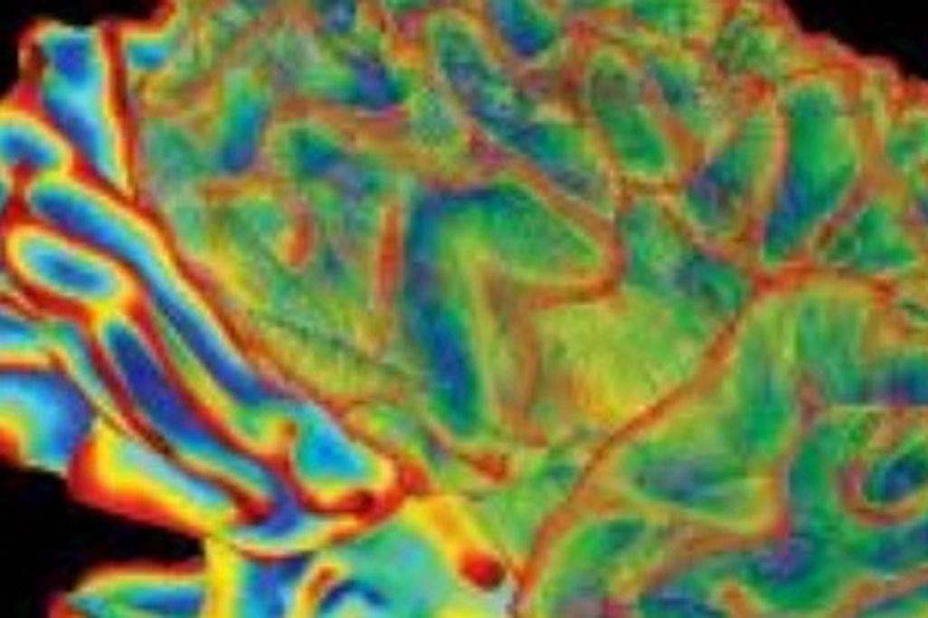 Brain research is now part of the daily news.