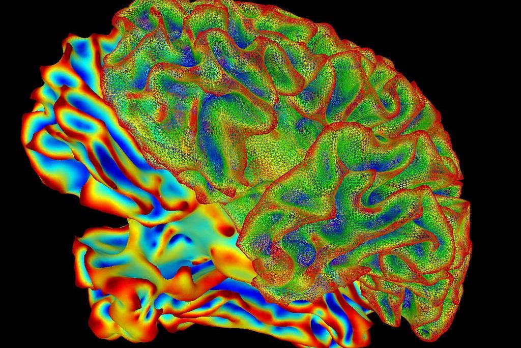 fMRI