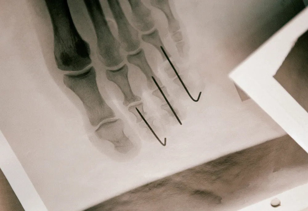 body-modification-foot-x-ray.jpg