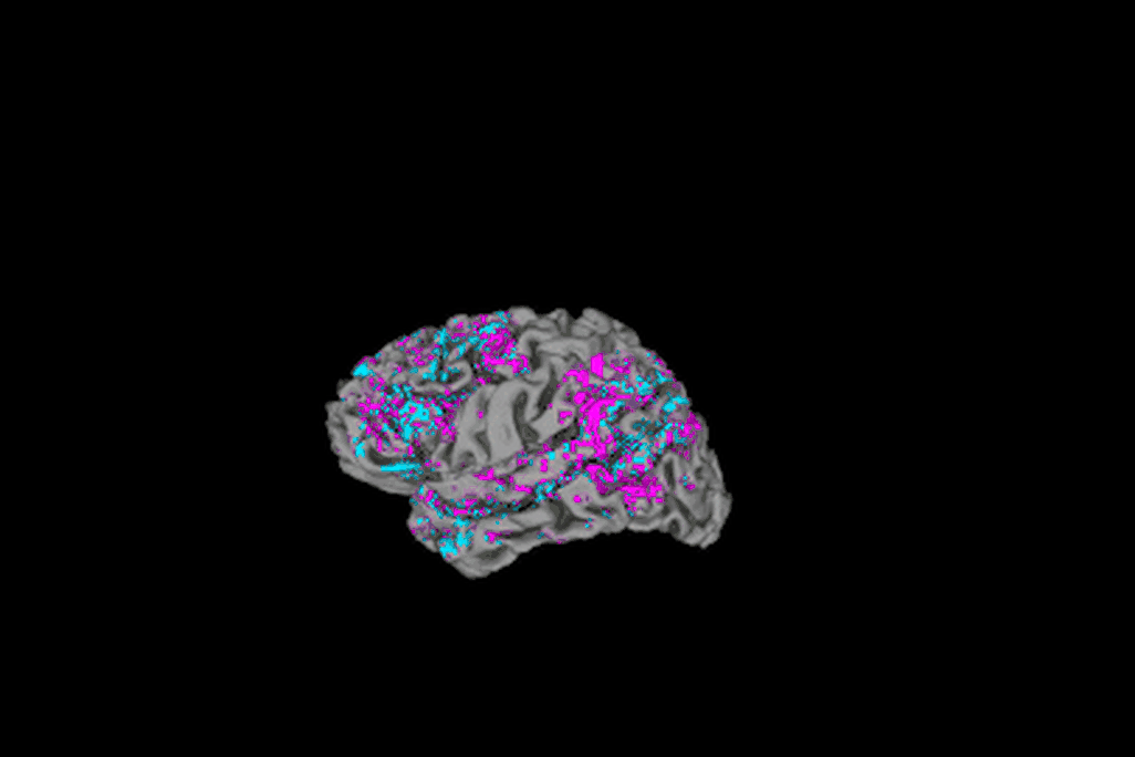 video of a spinning brain