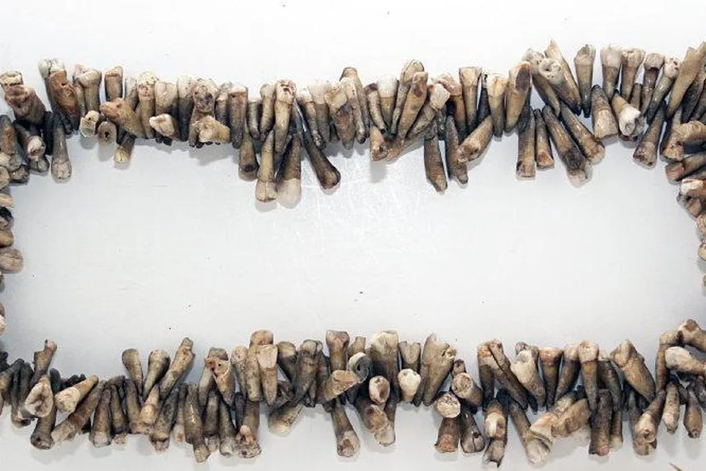 Tooth Necklace