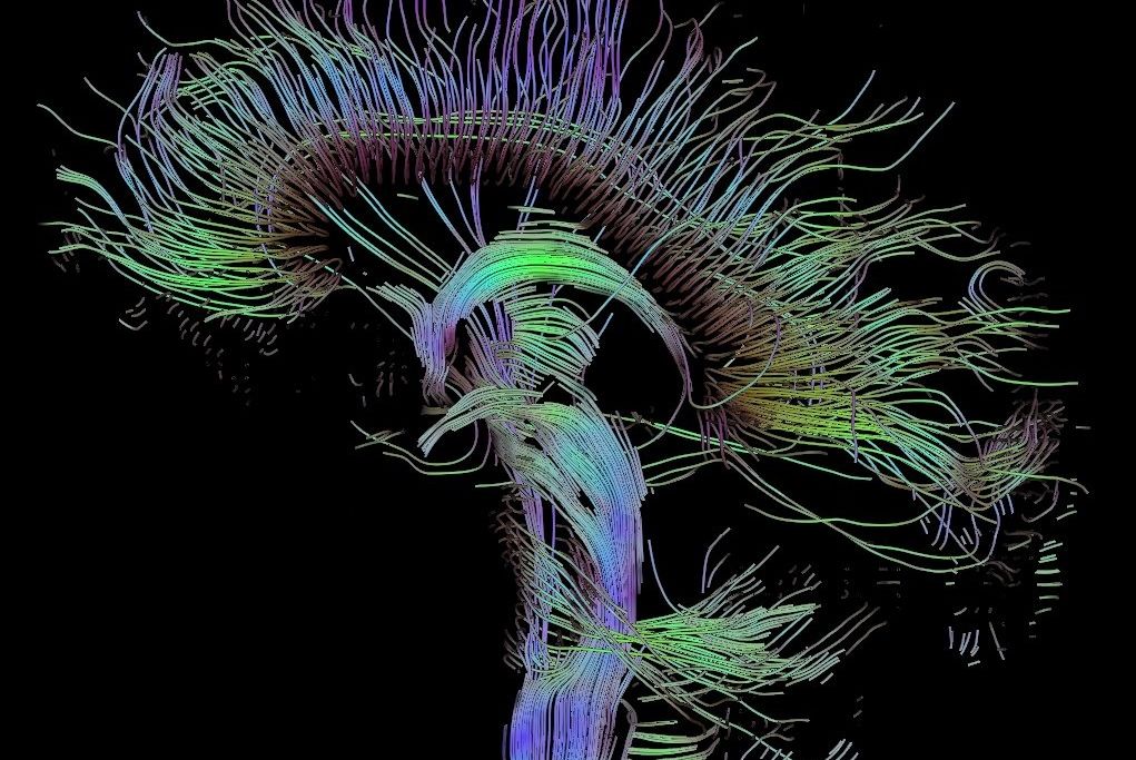 Brain Scan
