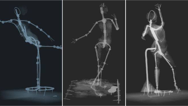 Degas X-rays