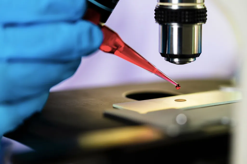 image of hand and pipette tip dripping blood into a dish under a microscope