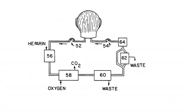 Good News, Everybody! Someone Once Patented Plans For Keeping A Severed Head Alive