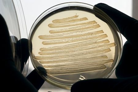 By combining genes from different bacteria species, scientists created E. coli that can produce diesel fuel from fat.