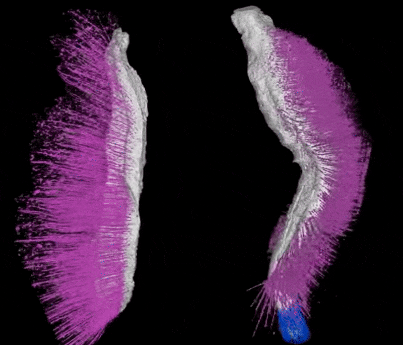 gif of two spiky-looking worms