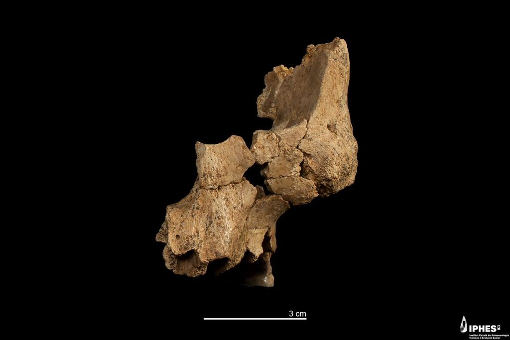 Fragments of a facial bone against a black background