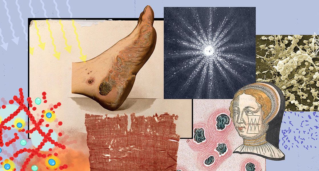 Scientists Are Using Nanomaterials to Heal Stubborn Wounds That Resist Antibiotic Treatment