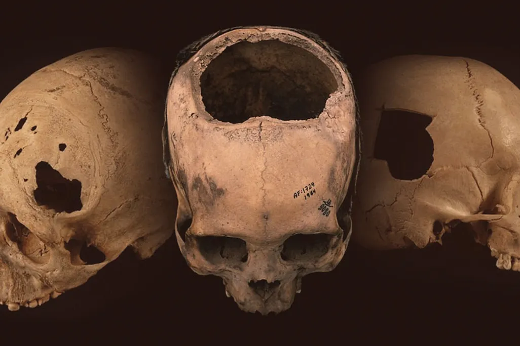 Skulls