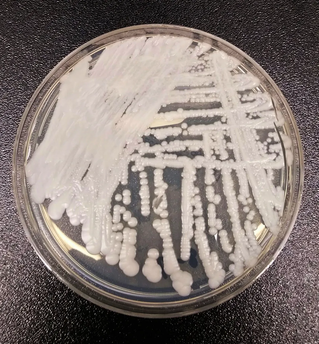 Petri dish with white lines of fungus