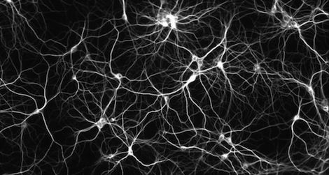 When neurons misfire