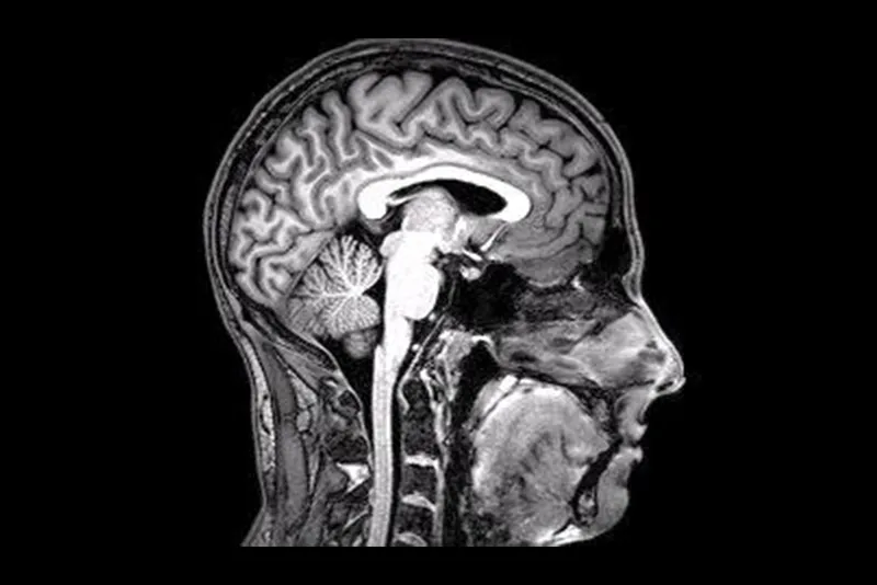 An fMRI scan of a human head in black and white. The scan is of a person's profile, facing the right edge of the photo. The scan highlights all the different organs in the head, like the brain, brain stem, mouth and nose.