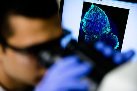 Sumit Bhatnagar, a PhD student in chemical engineering at the University of Michigan, inspects tumor cells used in developing a new diagnostic pill.