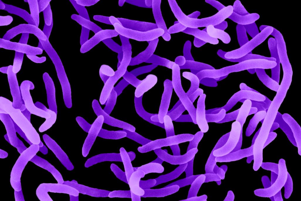 cholera