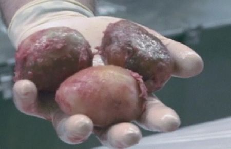Three of the 87 record eggs removed from the python