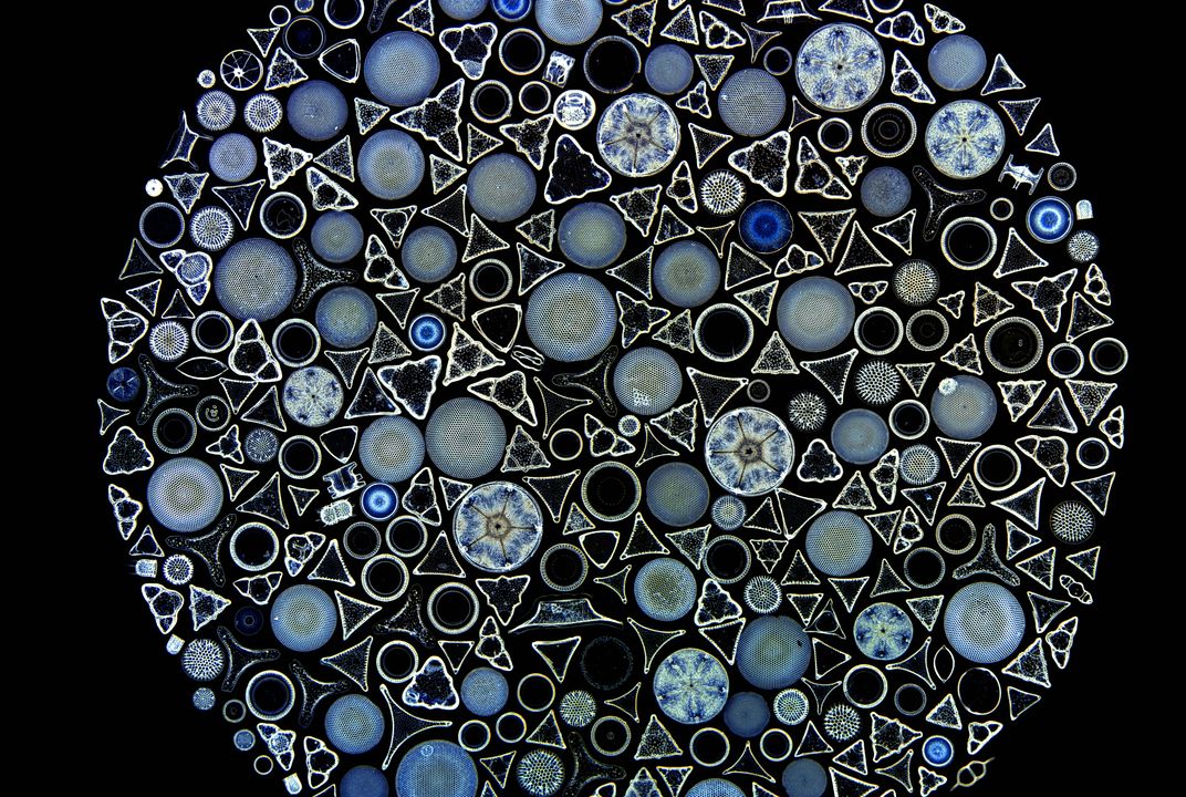 See 17 Intricate Microscope Photographs That Make the Miniature