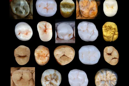 A collection of Hominin teeth used to determine the rate of tooth evolution among human ancestors.
