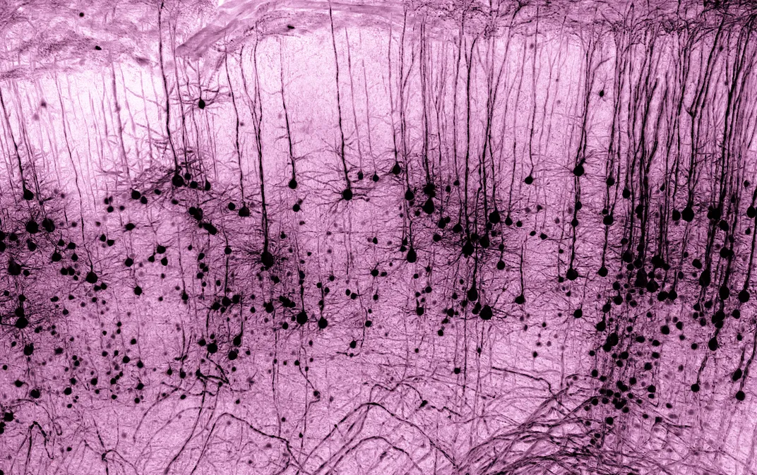 pink background with darker brown areas that look to drip from the top