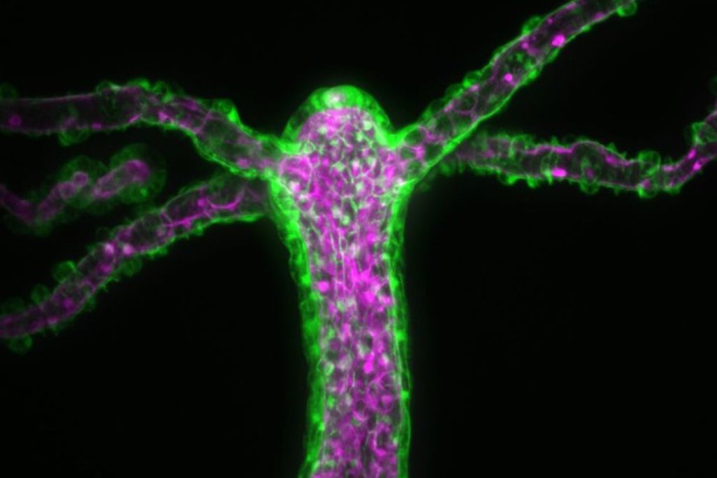 Transgenic Hydra