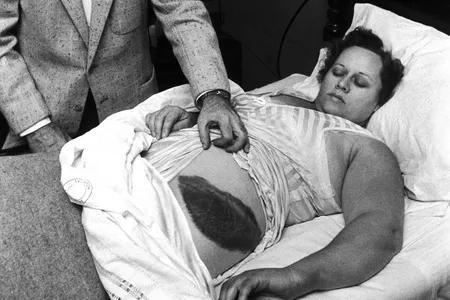 In the hubbub after the meteorite strike, Ann Hodges became a minor celebrity. Photographs of her bruise and the damage to her home appeared in Life magazine in an article entitled, “A Big Bruiser From the Sky.” 