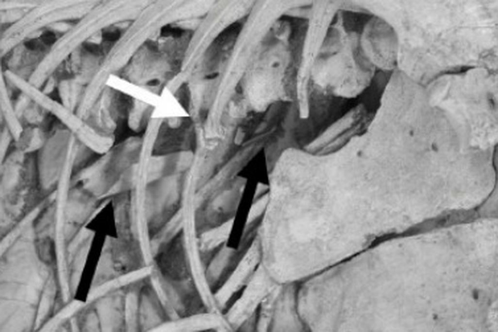 The chest cavity