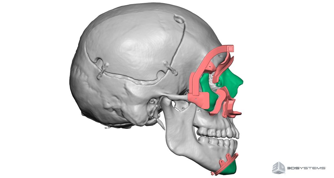 Saving Face: How One Pioneering Surgeon Is Pushing the Limits of Facial Transplants