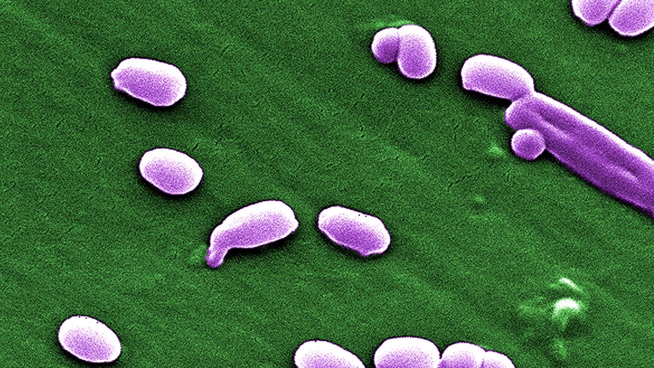 Turn Up the Heat: Bacterial Spores Can Take Temperatures in the