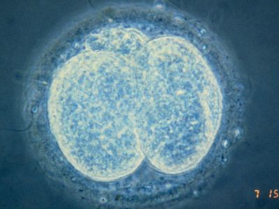 Light micrograph of a two-celled human zygote (the earliest stages of the embryo)