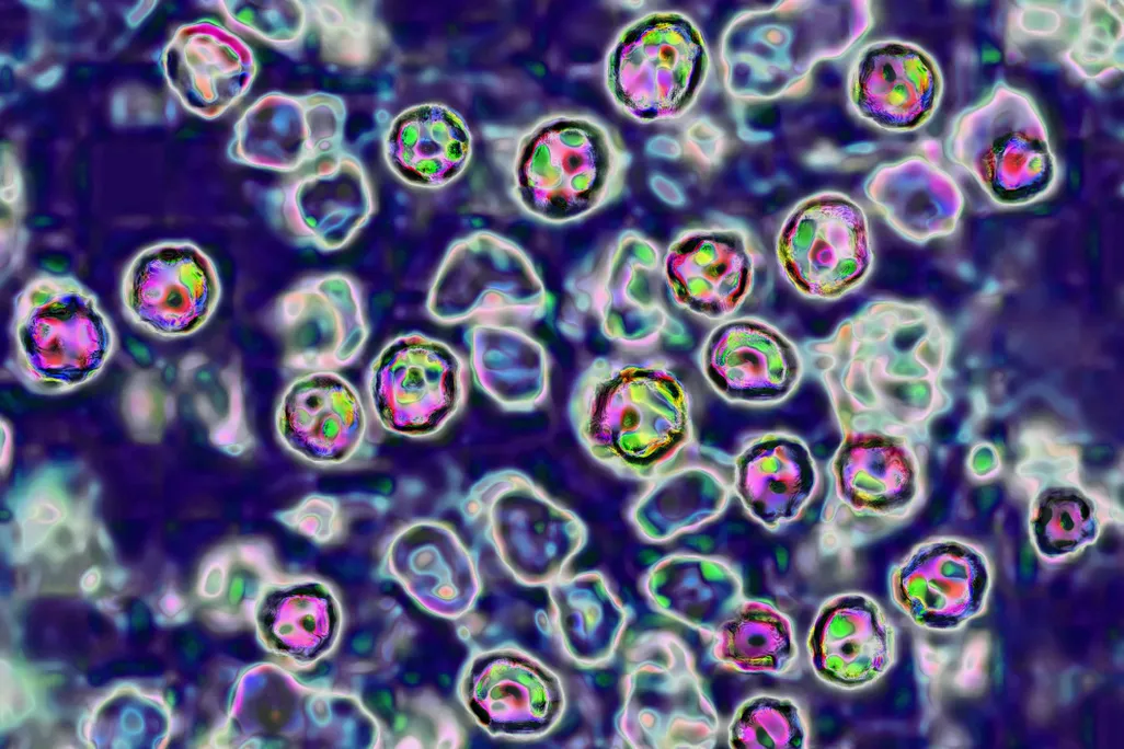 Measles virus seen through a microscope