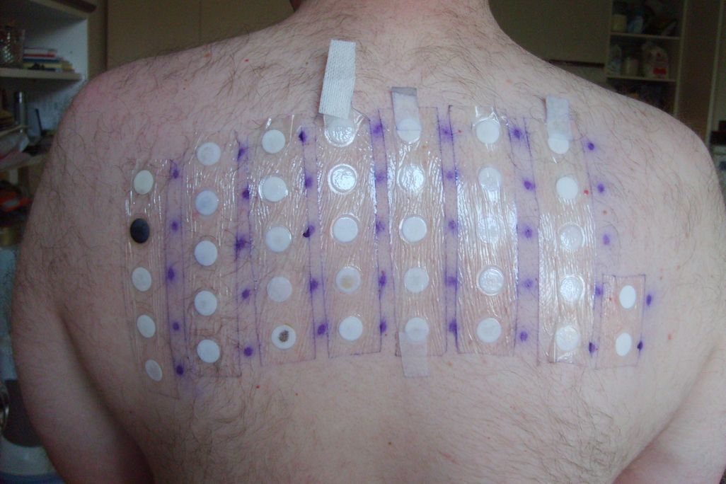 Patch test