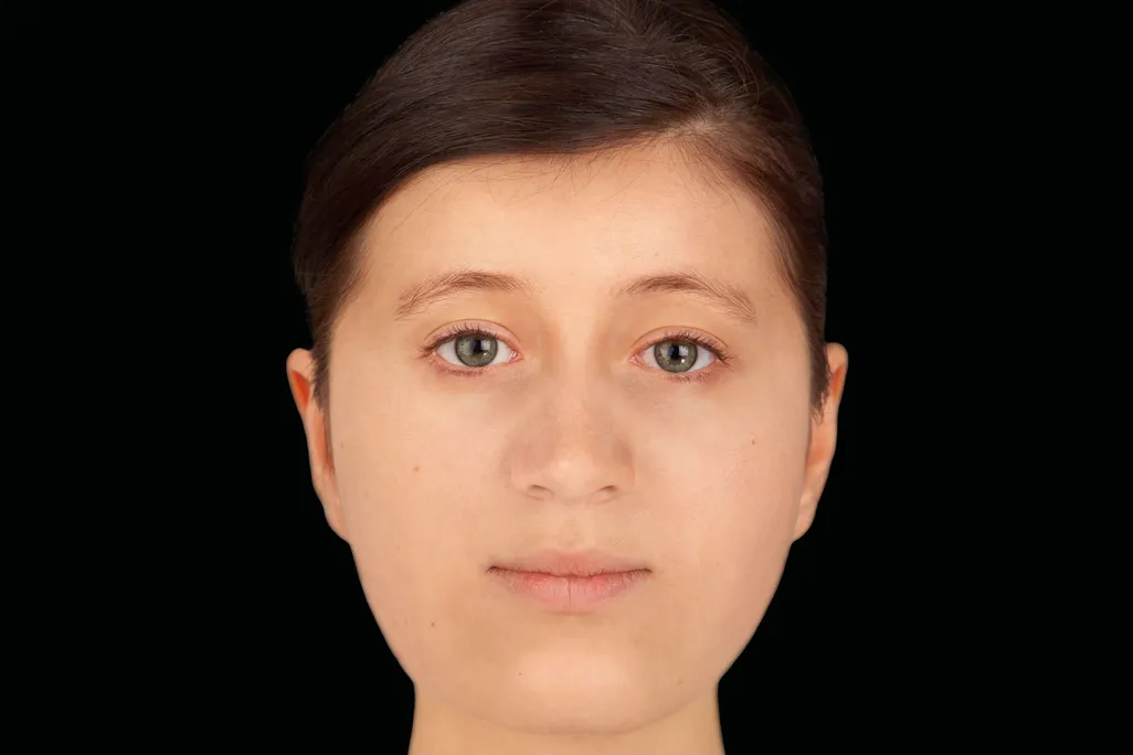 Facial reconstruction