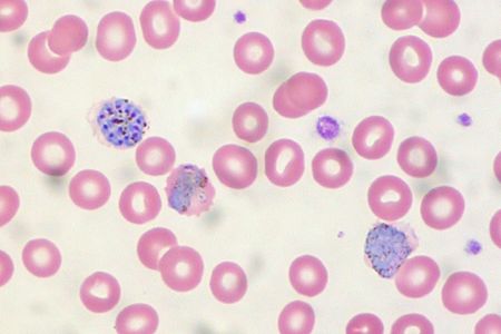Malaria infected blood cells (blue)