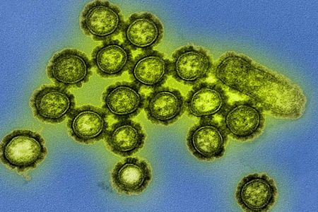H1N1 influenza virus particles shown in a colorized transmission electron micrograph