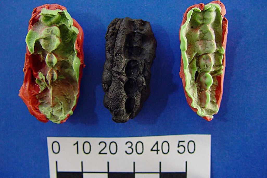 Three casts of chewing gum showing human bite marks