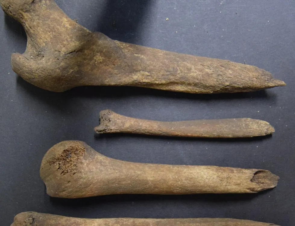 This Woman's Brains Were Scooped Out and Her Bones Were Broken and Whittled in Scotland 2,000 Years Ago image